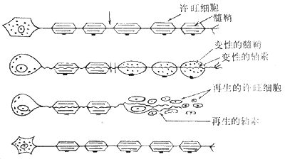 Waller变性模式图 (采自Escourolle)